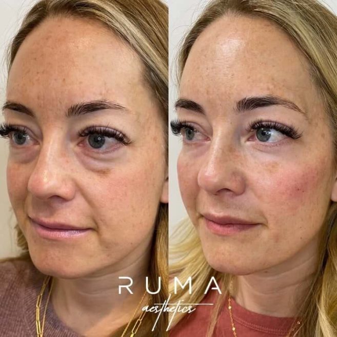 Ruma Medical
