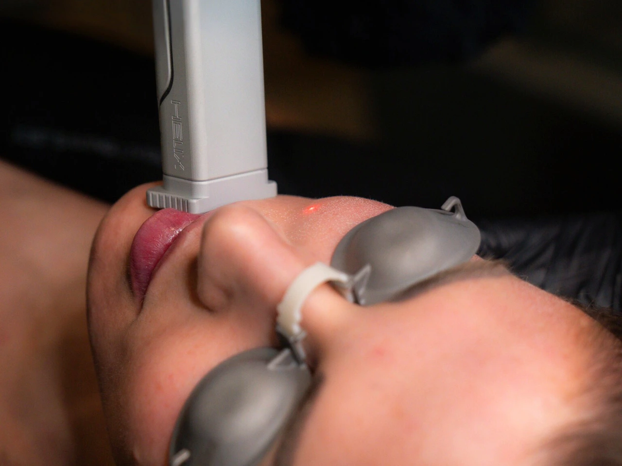 Helix Laser Resurfacing: Customizable Skin Rejuvenation